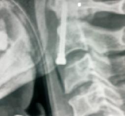 spine surgeon jammu