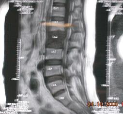 spine specialist jalandhar