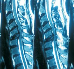 best spine doctor in jalandhar